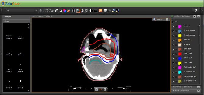 EduCase, Features, Contouring Tools, Magnifying Tools for DICOM images