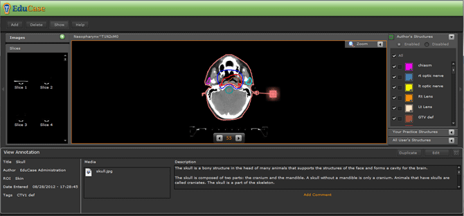 EduCase, Features, Contouring Tools, Annotations for DICOM images