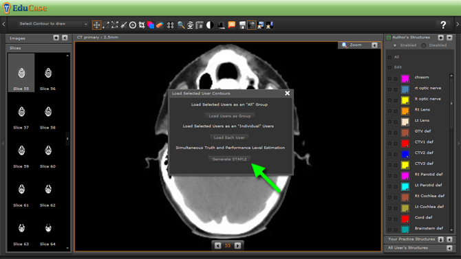 EduCase, Features, Load and Export Contours, STAPLE (Simultaneous truth and performance level estimation)